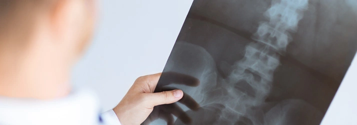 Person holding and examining a spinal X-ray image